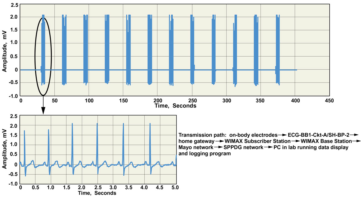 snapshots of ECG waveform digitized and transmitted from a physiological monitoring unit on a volunteer